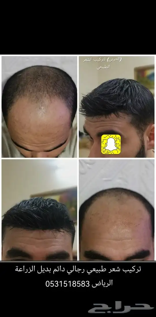 بوستيجة شعر طبيعي اصلي 1