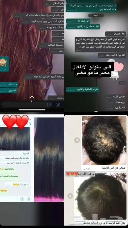 للعنايه بشعر 4