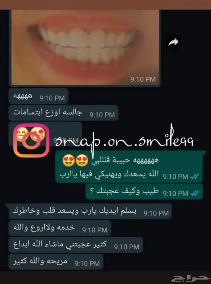 عروض على ابتسامة هوليود الفينير المتحركه اقساط 7