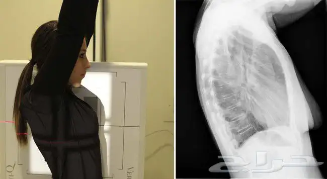 Radiology Mentor تدريب وتدريس على مواد الأشعة 7