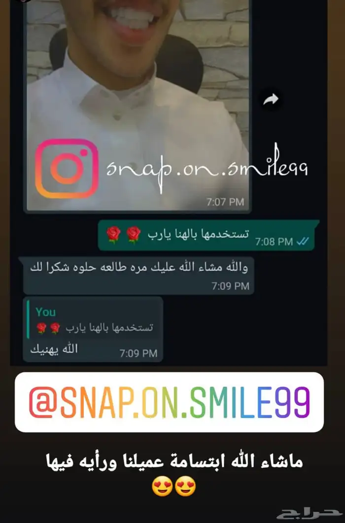 عروض على ابتسامة هوليود المتحركه اقساط 1