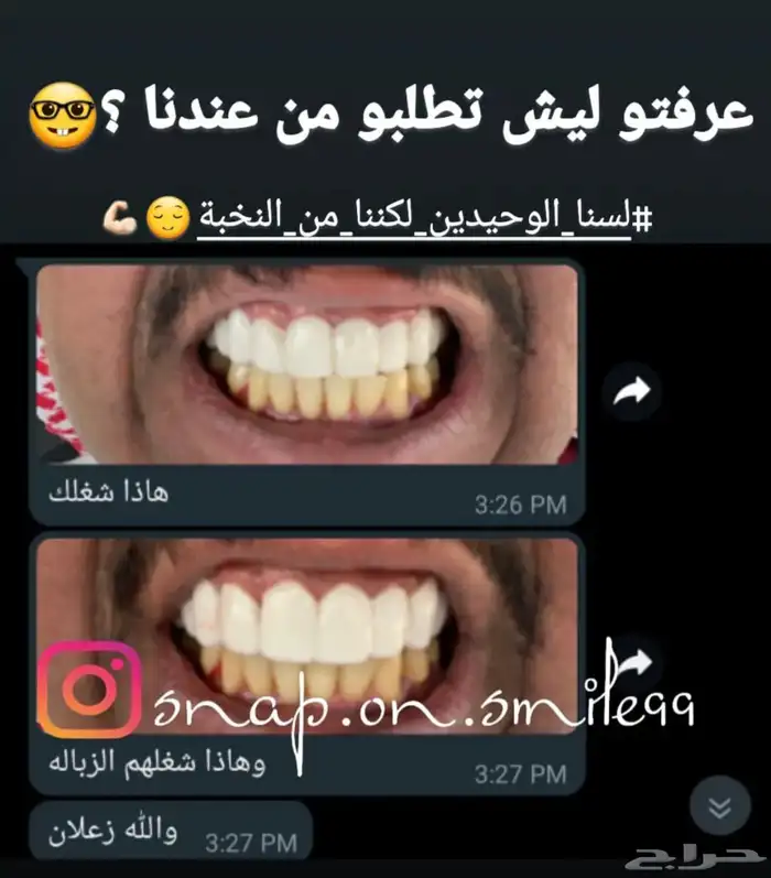 عروض على ابتسامة هوليود المتحركه اقساط 6