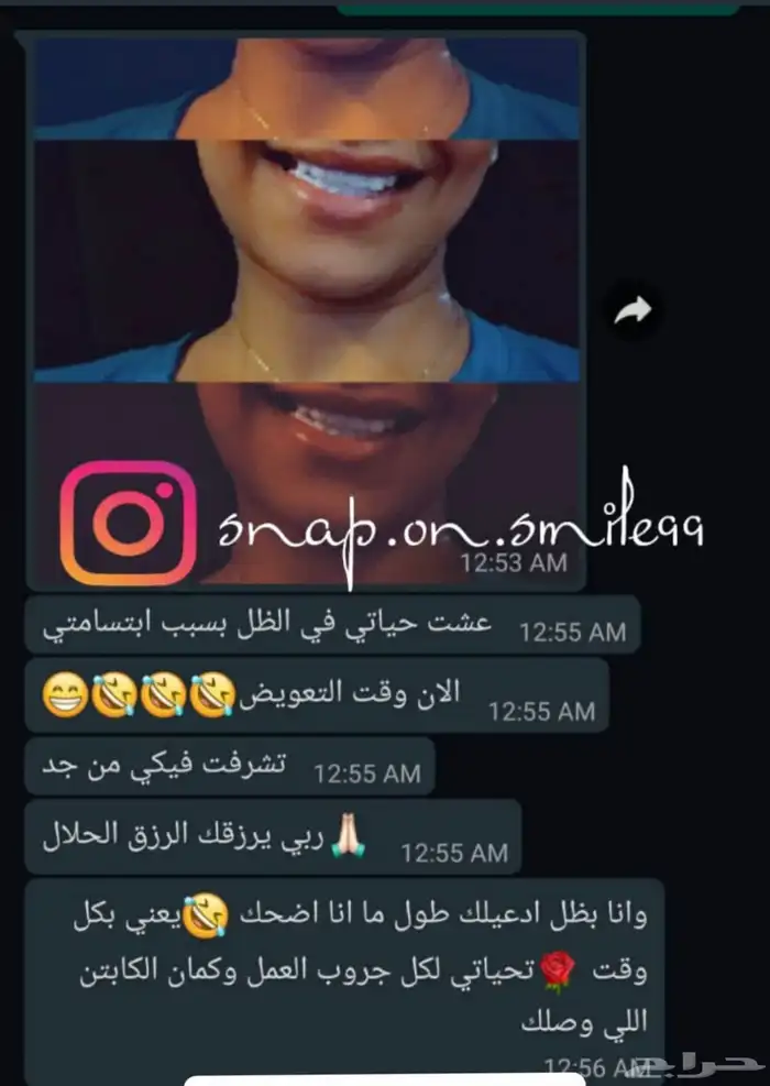 عروض على ابتسامة هوليود المتحركه اقساط 3