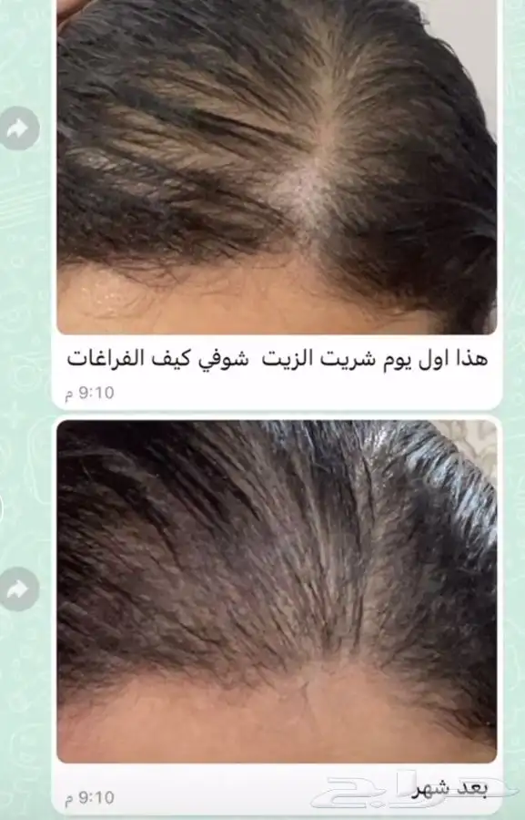 زيت القطران المغربي 2