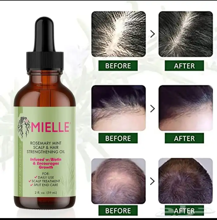 ( عرض لفتره محدوده ) زيت اكليل الجبل والنعناع 0