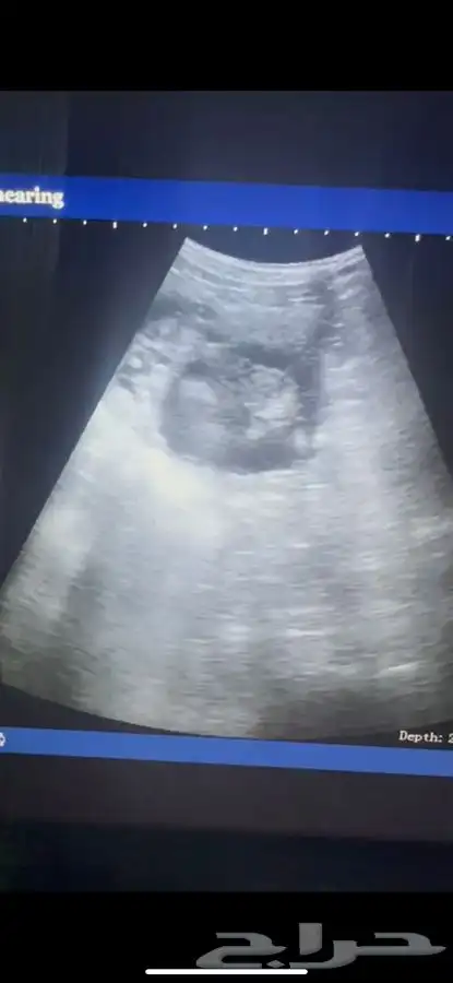 فحص سونار غنم 1