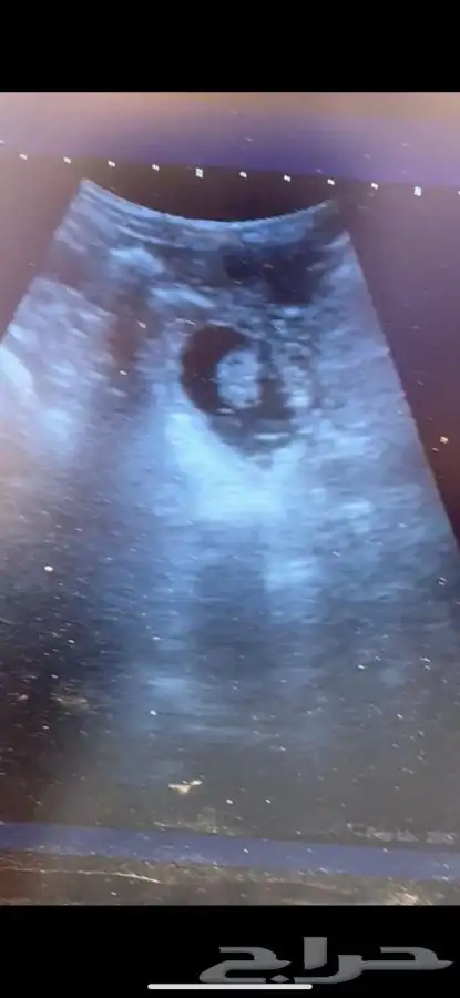 فحص سونار غنم 0