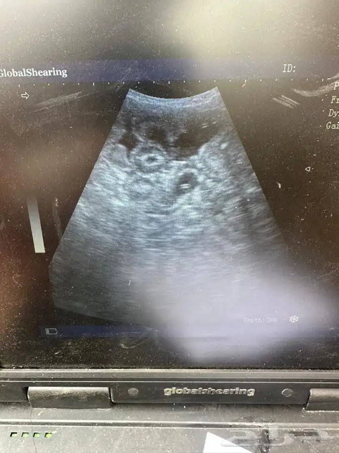 فحص سونار غنم 2