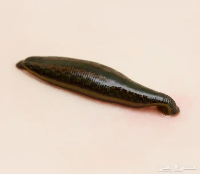 علق طبي 0