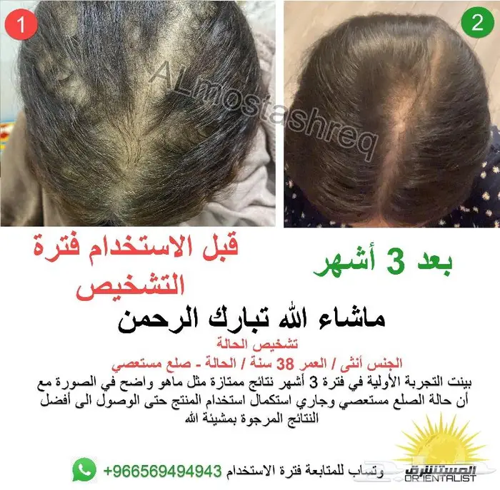 الزيت الاصلي من الوكيل الحصري المستشرق 10