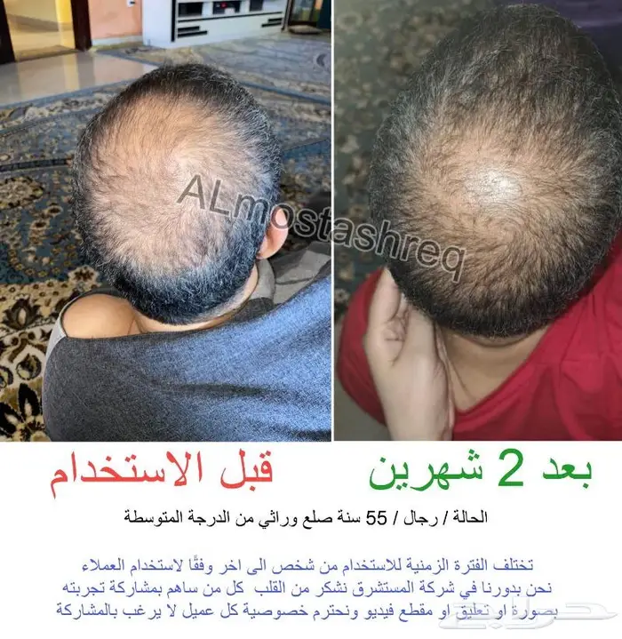 الزيت الاصلي من الوكيل الحصري المستشرق 6
