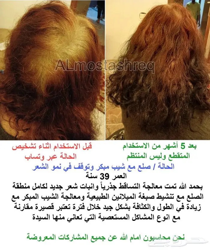 الزيت الاصلي من الوكيل الحصري المستشرق 20