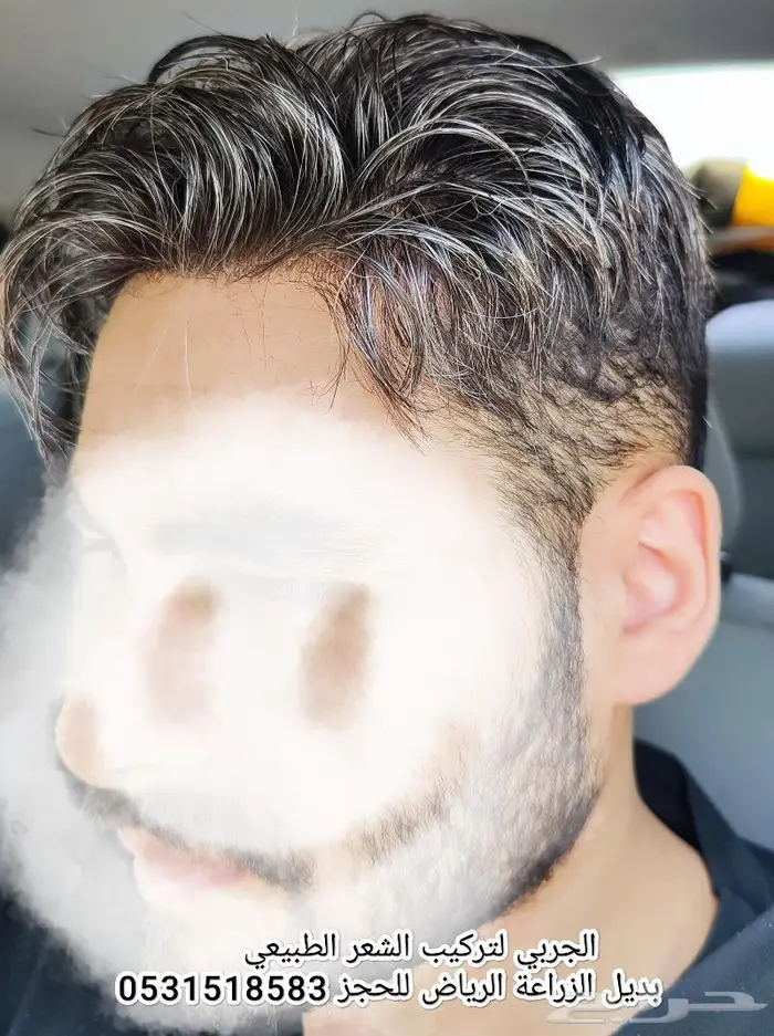 تركيب شعر 3