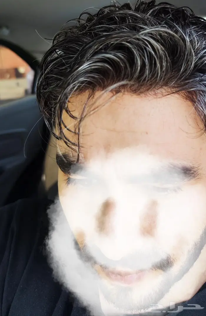 تركيب شعر رجالي طبيعي بديل الزراعة 3