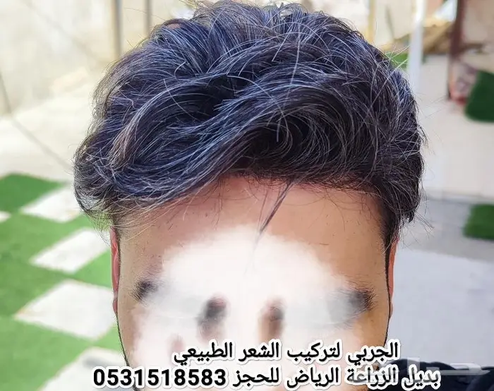 تركيب شعر رجالي طبيعي لصق 2