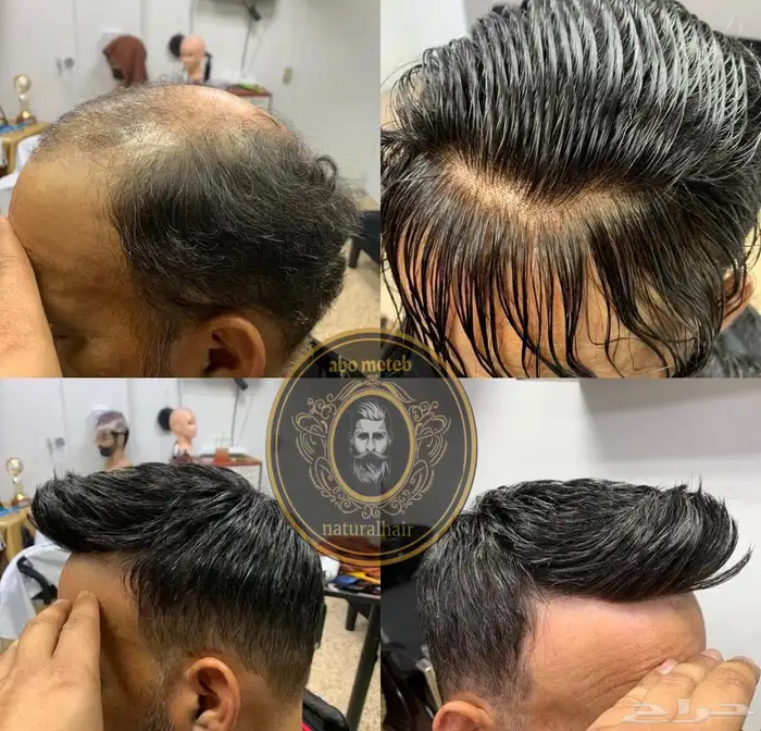 باروكة شعر(طبيعي)رجالي 7