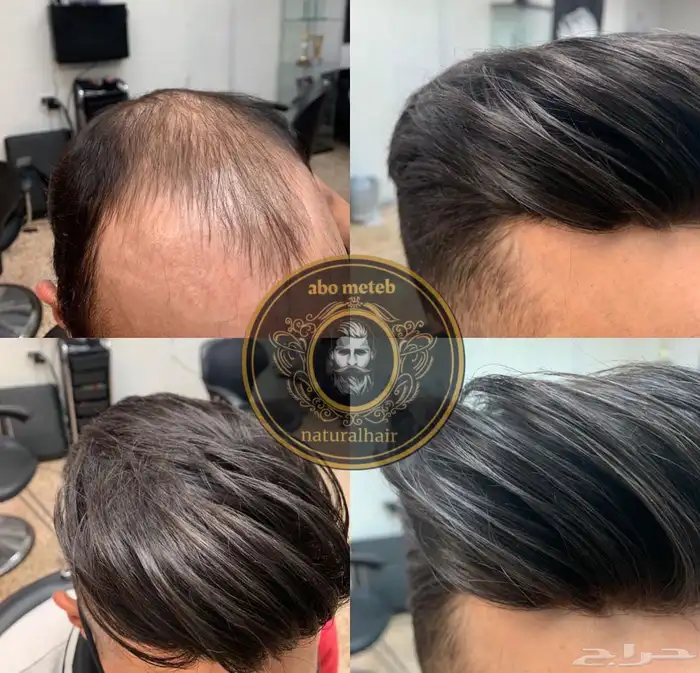 باروكة شعر (طبيعي)للرجال 9