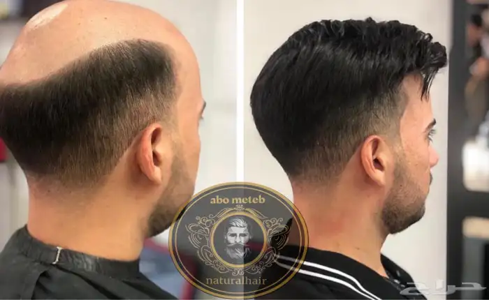 باروكة شعر(طبيعي)رجالي 3