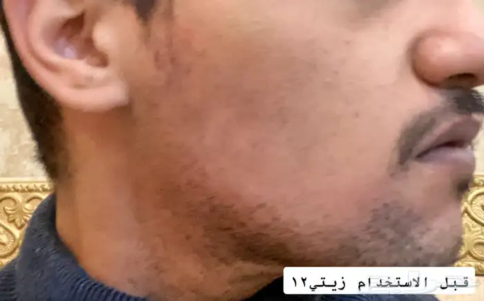 زيت افغاني 10