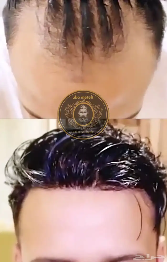 باروكة شعر (طبيعي) رجالي 9