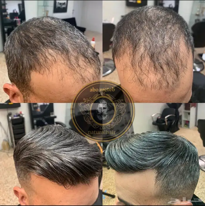 باروكة شعر(طبيعي)رجالي 12