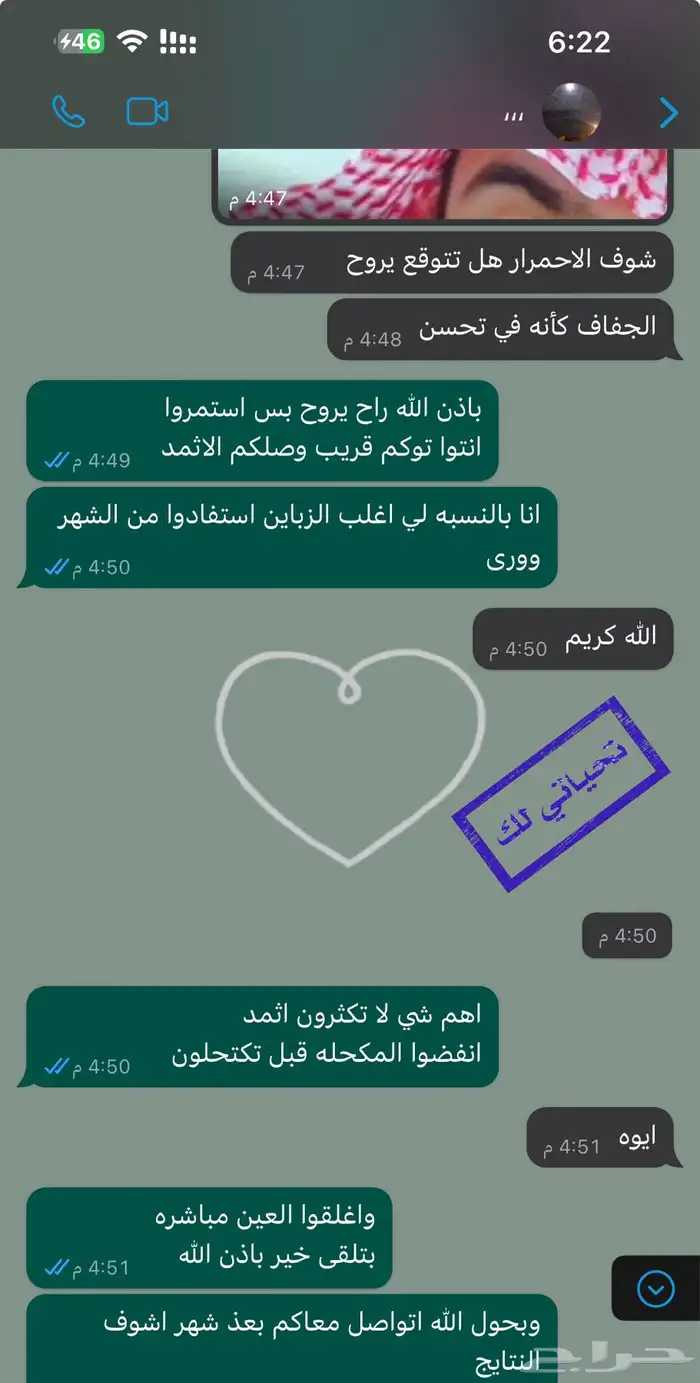كحل اثمد اصفهاني احمر ع لاجي نقي والحمدلله النتايج تشهد 33