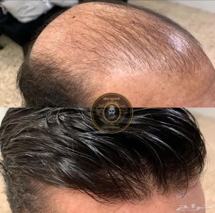 باروكة شعر(طبيعي) رجالي 10