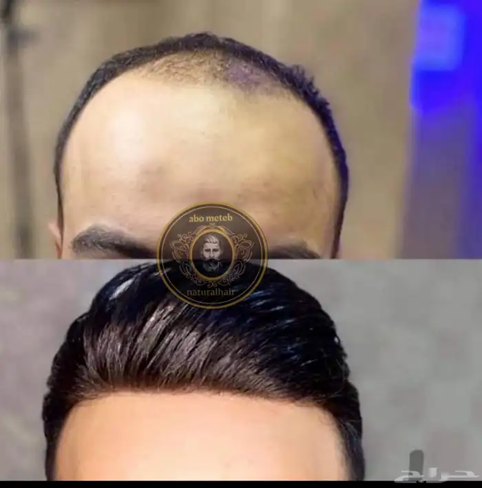 باروكة شعر(طبيعي) رجالي 3