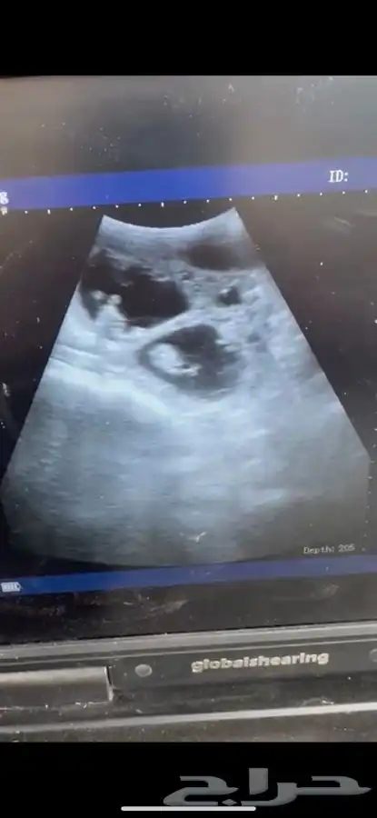 فحص سونار 1
