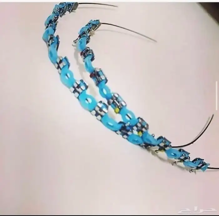 تقويم اسنان زينه محايل عسير 1