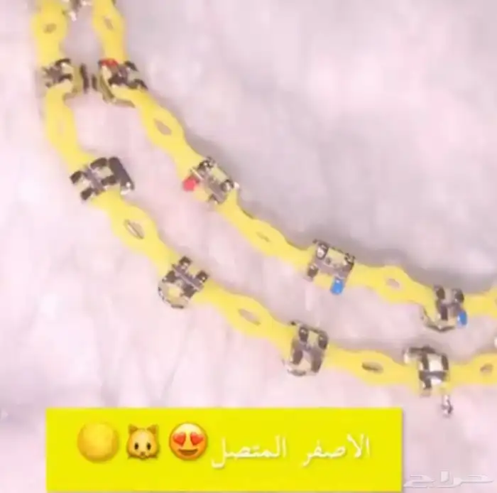 تقويم اسنان زينه محايل عسير 2