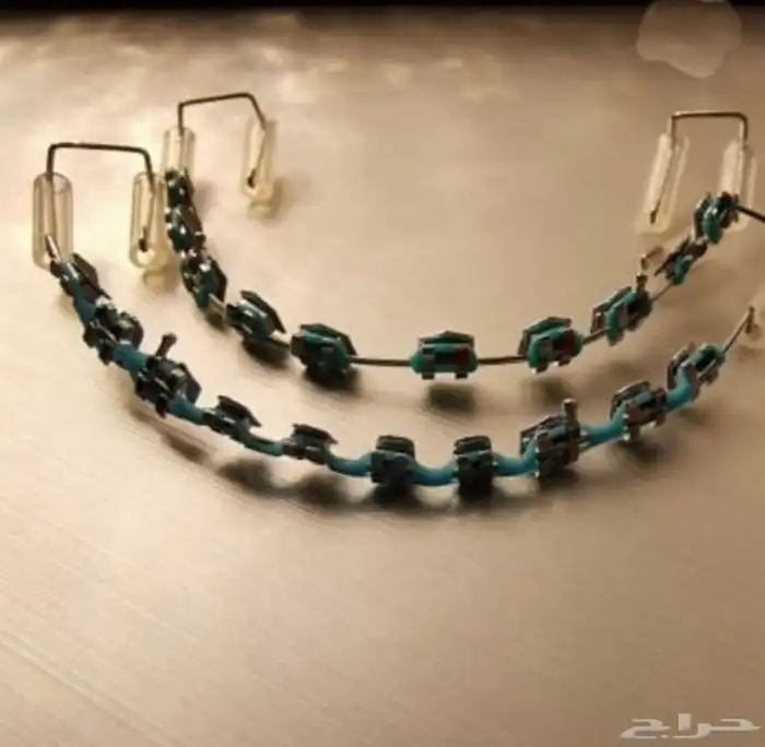 تقويم اسنان زينه محايل عسير 3