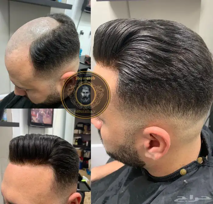 باروكة شعر (طبيعي)رجالي 11