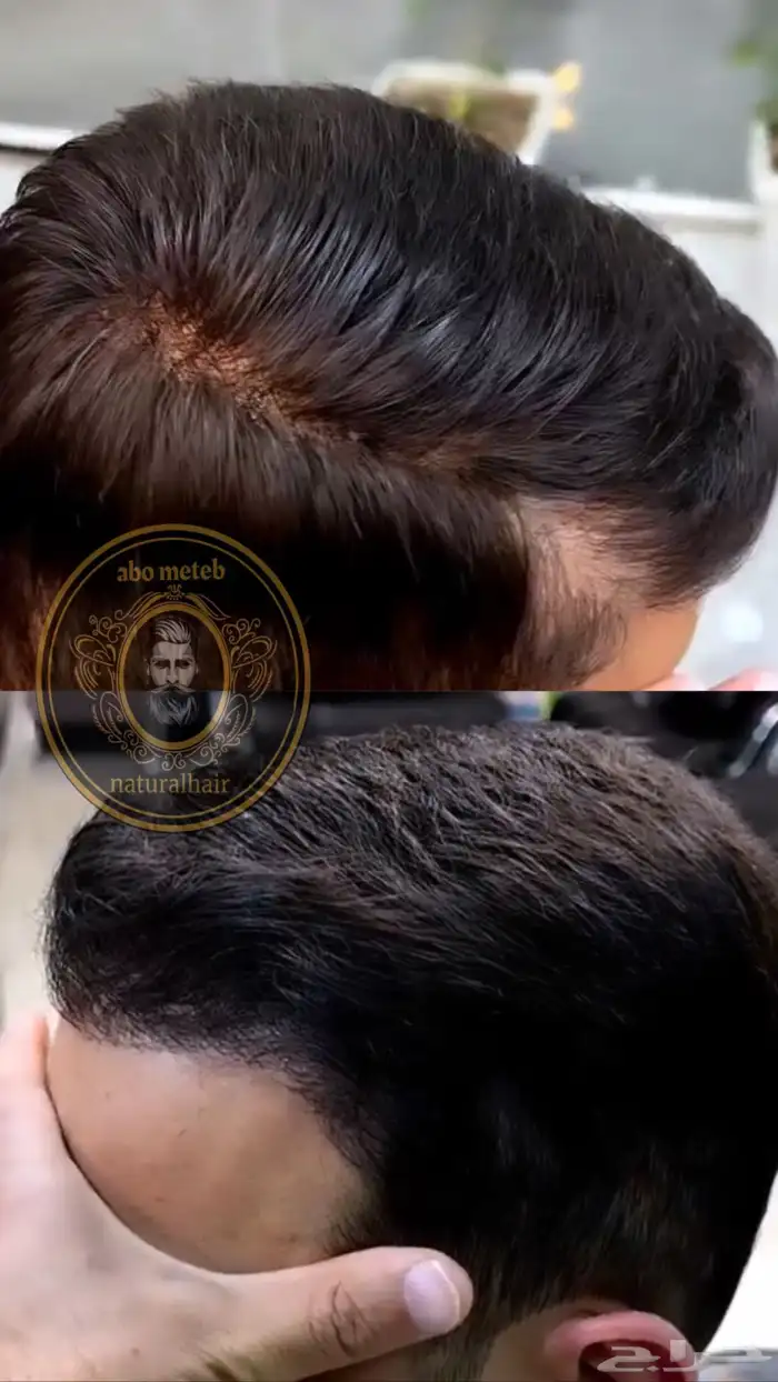 باروكة شعر (طبيعي)رجالي 5