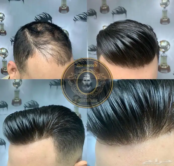 باروكة شعر (طبيعي)رجالي 1