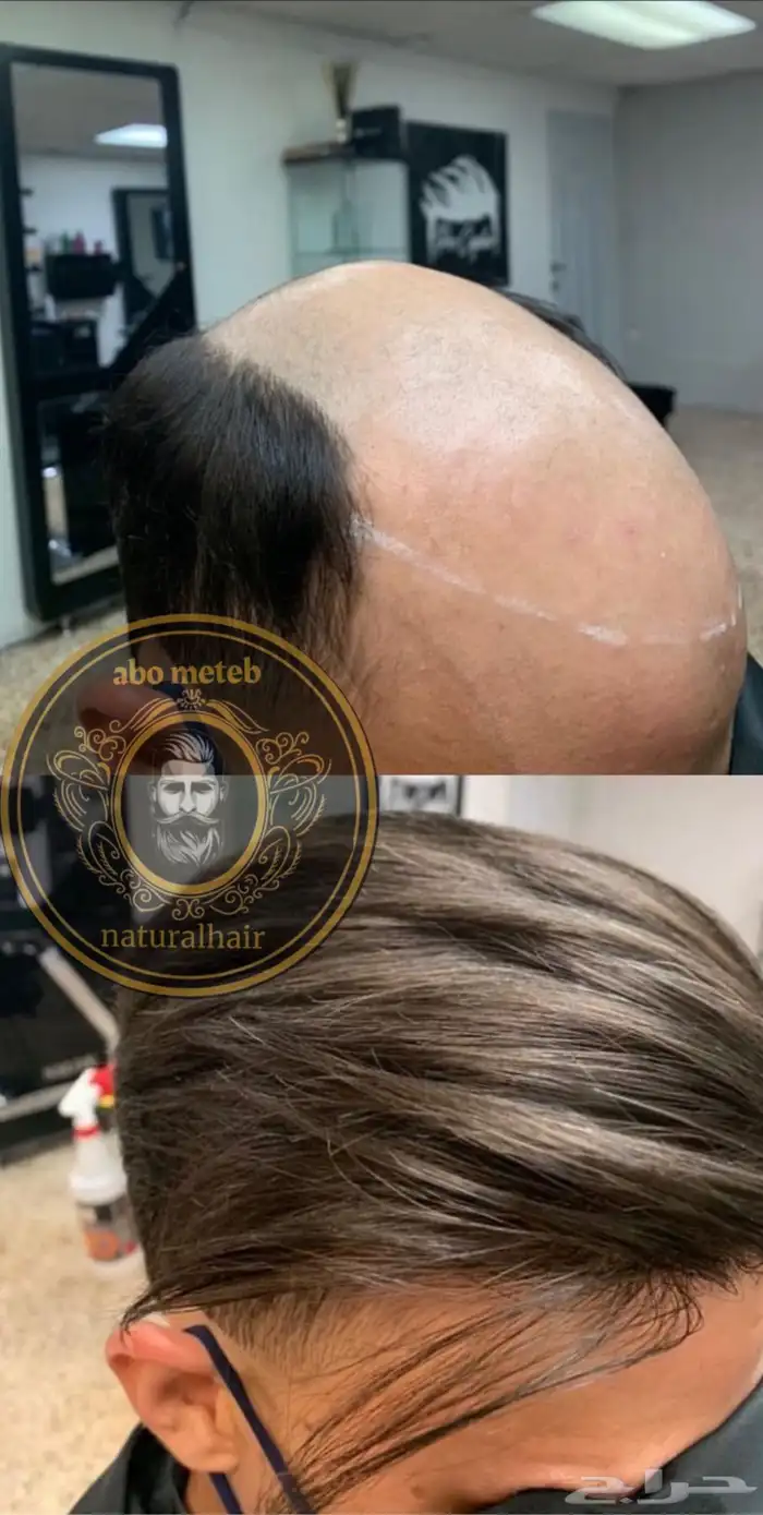 باروكة شعر (طبيعي)رجالي 14