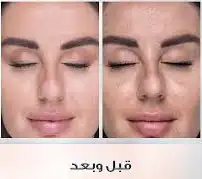 كريم تفتيح وتبييض البشرة في وقت قياسي وبشكل ملحوظ جدا 47