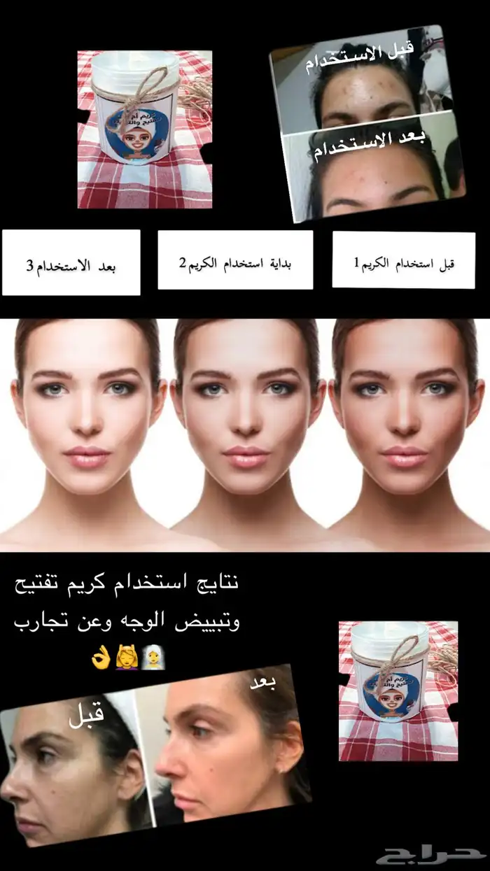 كريم تفتيح وتبييض البشرة في وقت قياسي وبشكل ملحوظ جدا 51