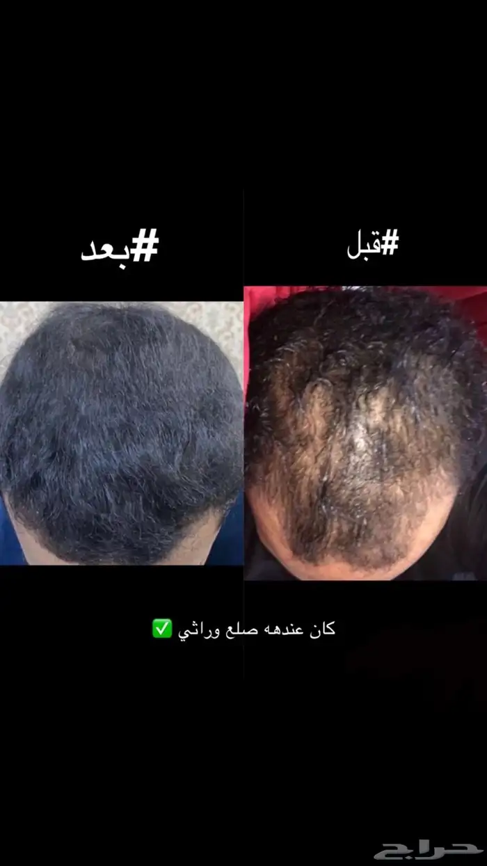 زيت الحشيش الافغاني الاصلي 2