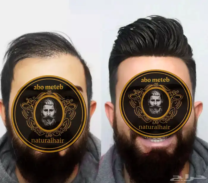 باروكة شعر (طبيعي)رجالي 3