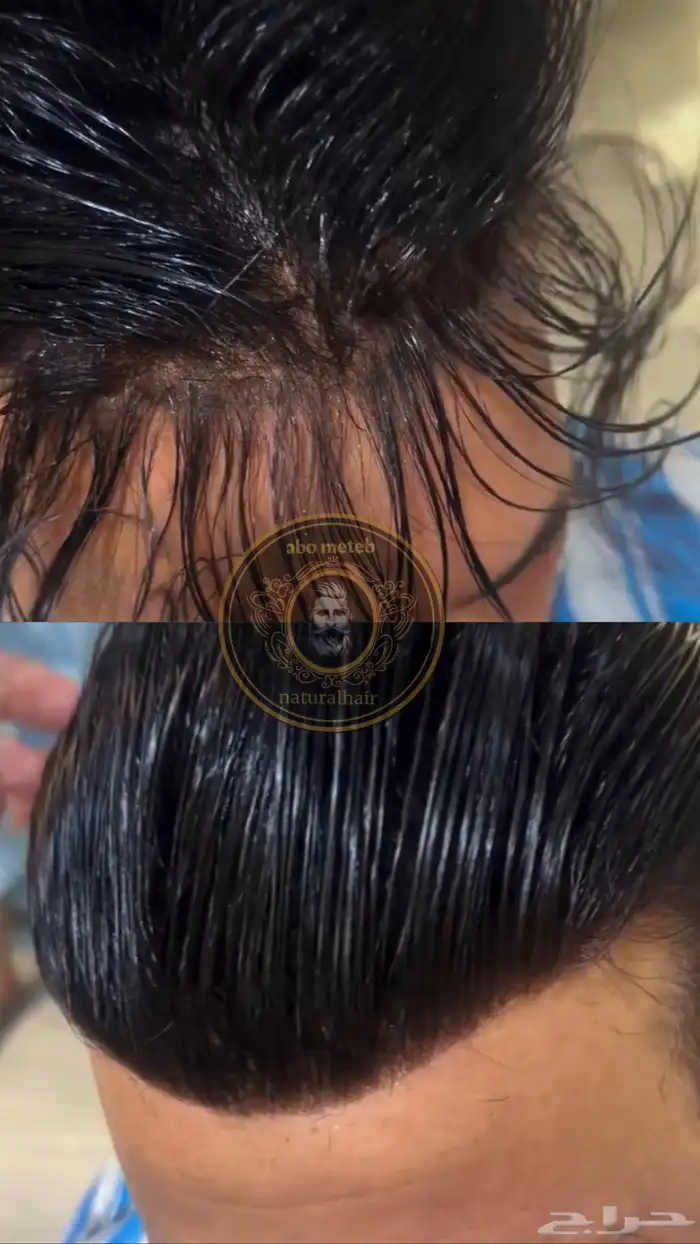 باروكة شعر(طبيعي)رجالي 3