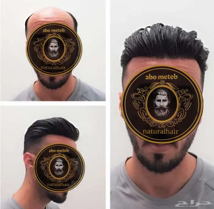 باروكة شعر(طبيعي)رجالي 0