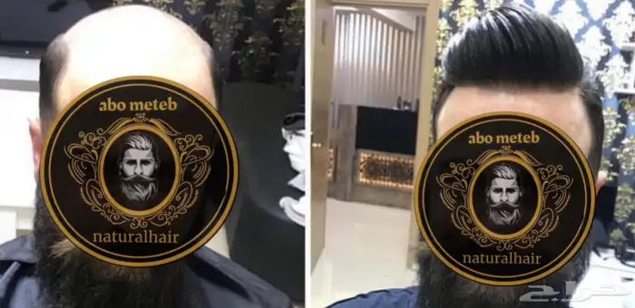 باروكة شعر(طبيعي)رجالي 18