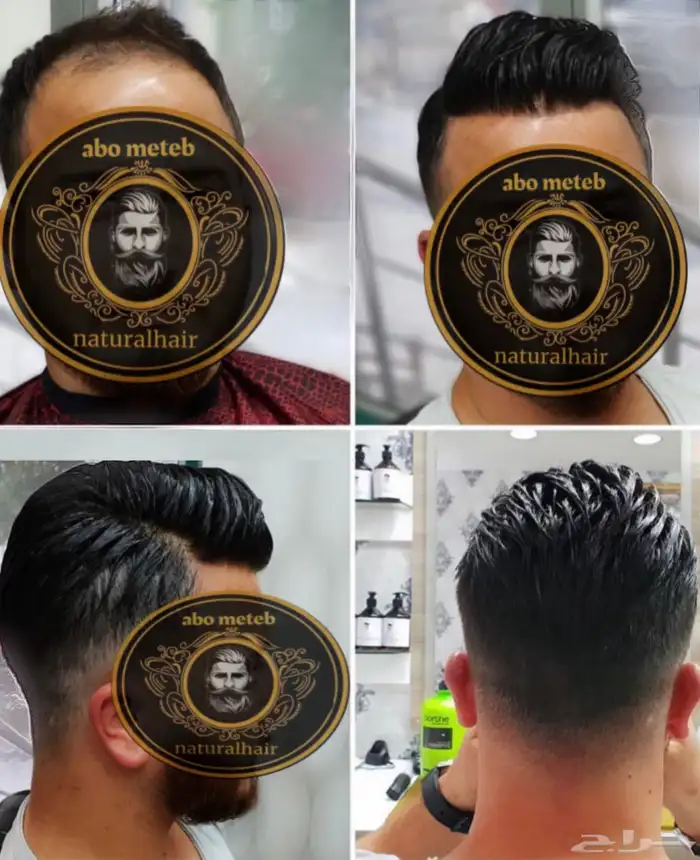 باروكة شعر (طبيعي) رجالي 5