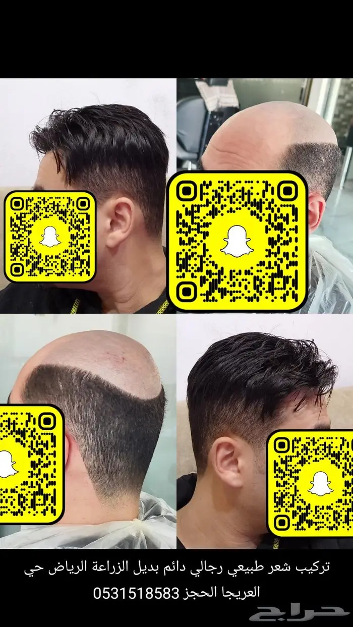 بوستيجه بديل الزراعه طبيعي 0