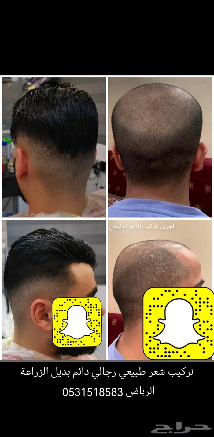 بوستيجه بديل الزراعه طبيعي 10