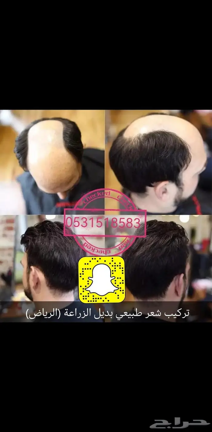 تركيب شعر رجالي طبيعي 0