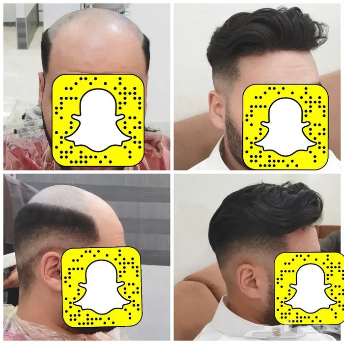 بوستيجه بديل الزراعه طبيعي 9