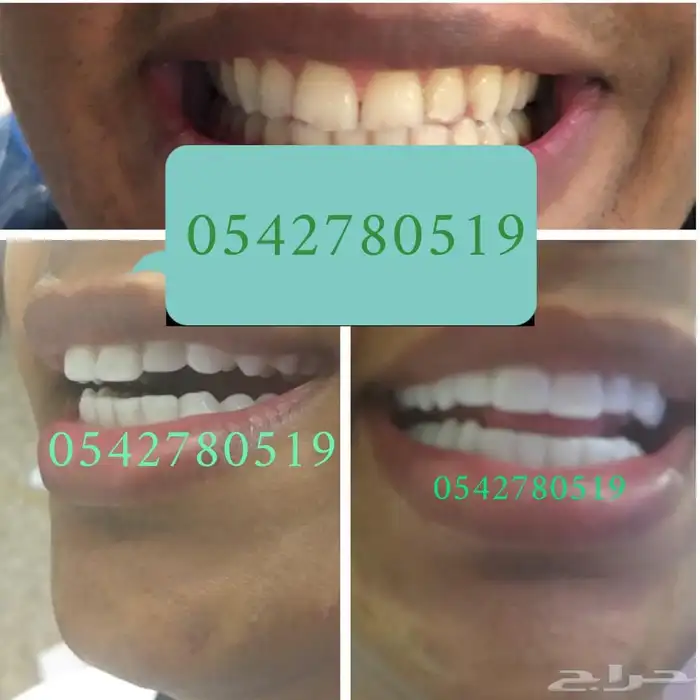 هوليود سمايل 3