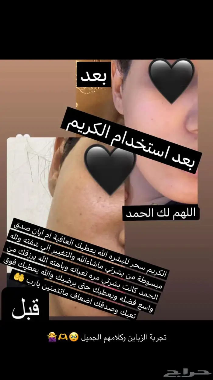 كريم تفتيح وتبييض البشرة في وقت قياسي وبشكل ملحوظ جدا 54